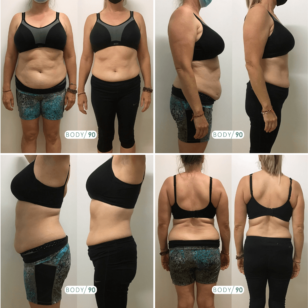 before after joining BODY90 Weight-loss program at MyBest Clinic Toronto